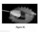 Fig. 07 - Soft robotic retractors