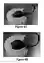 Fig. 08 - Soft robotic retractors