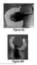 Fig. 09 - Soft robotic retractors