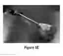 Fig. 13 - Soft robotic retractors