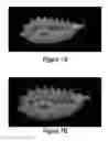 Fig. 15 - Soft robotic retractors