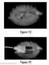 Fig. 16 - Soft robotic retractors