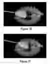 Fig. 17 - Soft robotic retractors