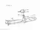 Fig. 02 - Tissue retractor apparatus and methods