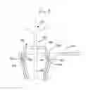 Fig. 07 - Tissue retractor apparatus and methods