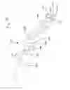 Fig. 11 - Tissue retractor apparatus and methods
