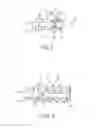 Fig. 04 - Threaded knotless anchor