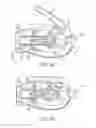 Fig. 15 - Threaded knotless anchor