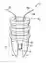 Fig. 01 - Suture anchor system with compressible distal tip