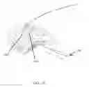 Fig. 15 - Methods for passing multiple sutures through tissue