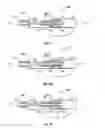 Fig. 10 - Multiple member interconnect for surgical instrument and absorbable screw fastener