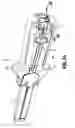 Fig. 03 - Surgical fastener applying apparatus