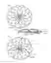 Fig. 08 - Occluder and anastomosis devices