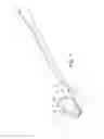 Fig. 02 - Tool for insertion into a surgical saw, and method for milling a groove