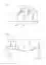 Fig. 03 - Tool for insertion into a surgical saw, and method for milling a groove