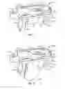 Fig. 05 - Surgical instrumentation and methods of use for implanting a prosthesis