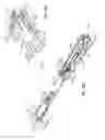 Fig. 08 - Surgical instrumentation and methods of use for implanting a prosthesis