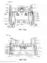 Fig. 11 - Surgical instrumentation and methods of use for implanting a prosthesis