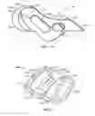Fig. 12 - Surgical instrumentation and methods of use for implanting a prosthesis