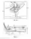 Fig. 15 - Surgical instrumentation and methods of use for implanting a prosthesis