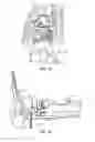 Fig. 17 - Surgical instrumentation and methods of use for implanting a prosthesis