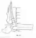 Fig. 19 - Surgical instrumentation and methods of use for implanting a prosthesis