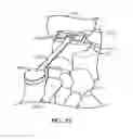 Fig. 20 - Surgical instrumentation and methods of use for implanting a prosthesis