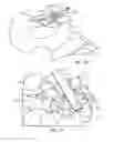 Fig. 22 - Surgical instrumentation and methods of use for implanting a prosthesis