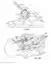 Fig. 23 - Surgical instrumentation and methods of use for implanting a prosthesis
