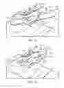 Fig. 25 - Surgical instrumentation and methods of use for implanting a prosthesis