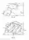 Fig. 26 - Surgical instrumentation and methods of use for implanting a prosthesis