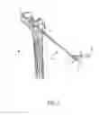 Fig. 02 - SYSTEM AND METHOD OF TREATMENT OF BONE LESIONS