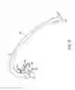 Fig. 08 - Cross pinning guide devices and methods