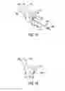 Fig. 11 - Cross pinning guide devices and methods