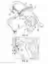 Fig. 13 - Cross pinning guide devices and methods