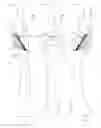 Fig. 03 - Soft tissue reconstruction