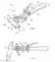 Fig. 04 - Soft tissue reconstruction