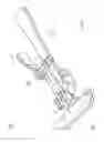 Fig. 09 - Soft tissue reconstruction