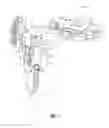 Fig. 02 - Gap referencing femoral sizer