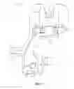 Fig. 03 - Gap referencing femoral sizer