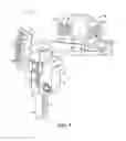 Fig. 04 - Gap referencing femoral sizer