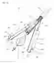 Fig. 03 - SHOCK WAVE VALVULOPLASTY DEVICE AND METHODS