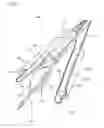 Fig. 04 - SHOCK WAVE VALVULOPLASTY DEVICE AND METHODS