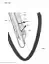 Fig. 12 - SHOCK WAVE VALVULOPLASTY DEVICE AND METHODS