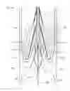 Fig. 13 - SHOCK WAVE VALVULOPLASTY DEVICE AND METHODS