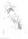 Fig. 04 - Medical instrument