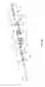 Fig. 08 - MINIMALLY INVASIVE MICRO TISSUE DEBRIDERS HAVING TARGETED ROTOR POSITIONS