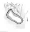 Fig. 02 - Identification of elastic lamina to guide interventional therapy
