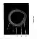 Fig. 04 - Identification of elastic lamina to guide interventional therapy