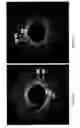 Fig. 08 - Identification of elastic lamina to guide interventional therapy